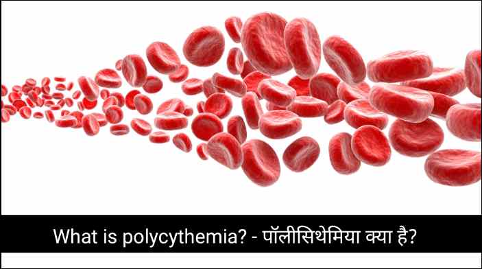 What is polycythemia