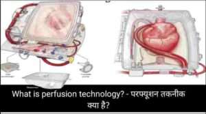 What is perfusion technology? - परफ्यूशन तकनीक क्या है?