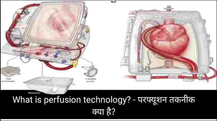 What is perfusion technology? - परफ्यूशन तकनीक क्या है?