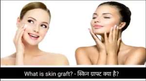 What is skin graft? – स्किन ग्राफ्ट क्या है?