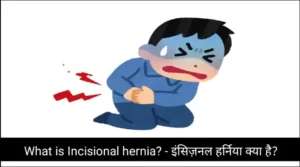 What is Incisional hernia? – इंसिज़नल हर्निया क्या है?