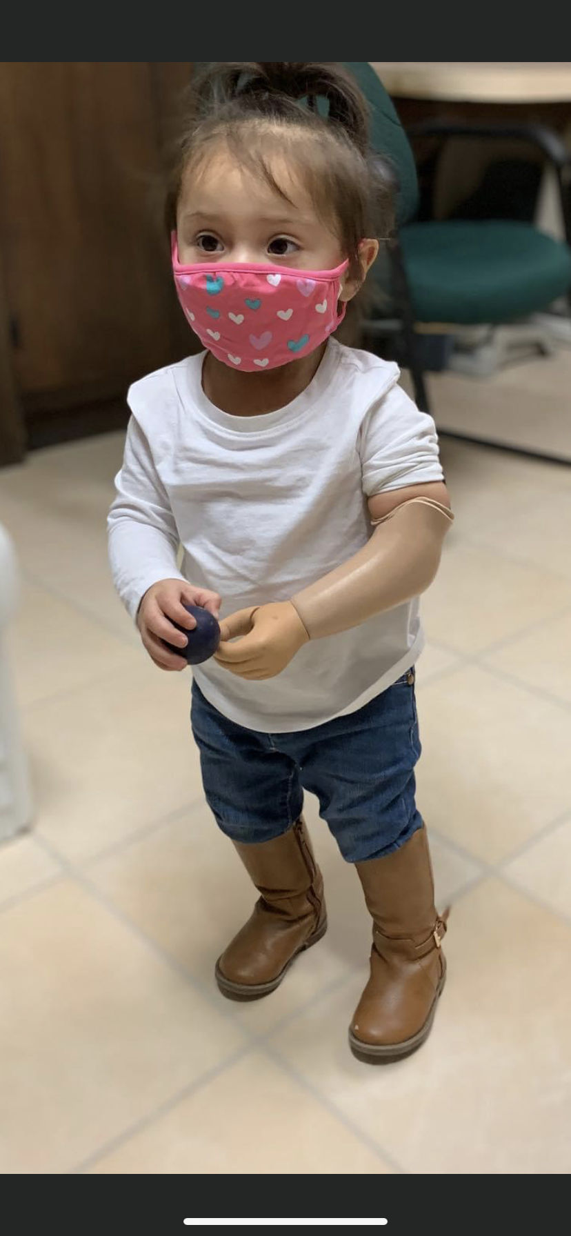 Child with a pediatric prosthetic leg playing outdoors