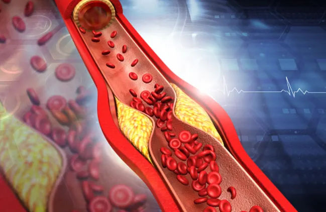 Poor diet damages blood vessels: Study