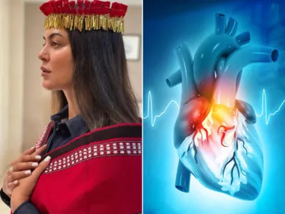 Heart Attack rate has risen among those age 35 between 54 especially women.