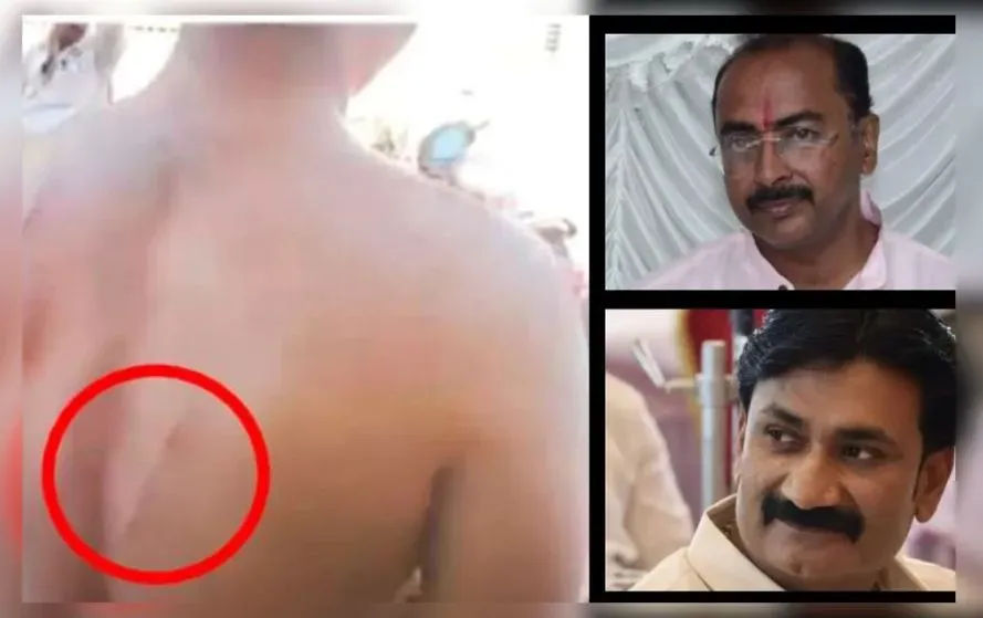इंदौर भाजपा पार्षद बेटे के साथ हुई मारपीट का मामला पहुंचा मानव अधिकार आयोग के पास