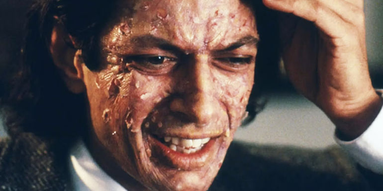 Seth Brundle (Jeff Goldblum) worried as his skin peels off in The Fly