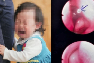 Bí mật kinh hoàng trong lỗ mũi của bé gái 13 tháng tuổi ở Bình Thuận