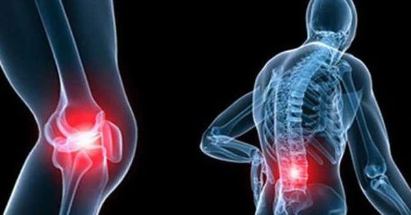 Những Món Ăn Có Thể Rút Cạn Canxi Trong Cơ Thể Bạn: Đừng Làm Xương Giòn Hơn!