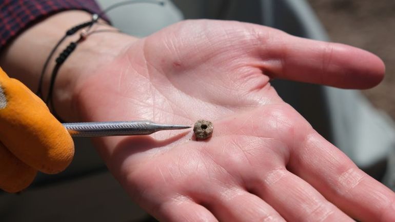 Ancient Facial Piercings Unearthed in Turkey, Marking Archaeological Milestone