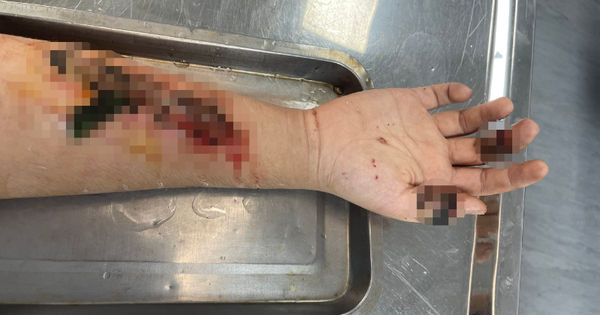 Những Sai Lầm Nguy Hiểm Khi Chữa Bệnh Tại Nhà