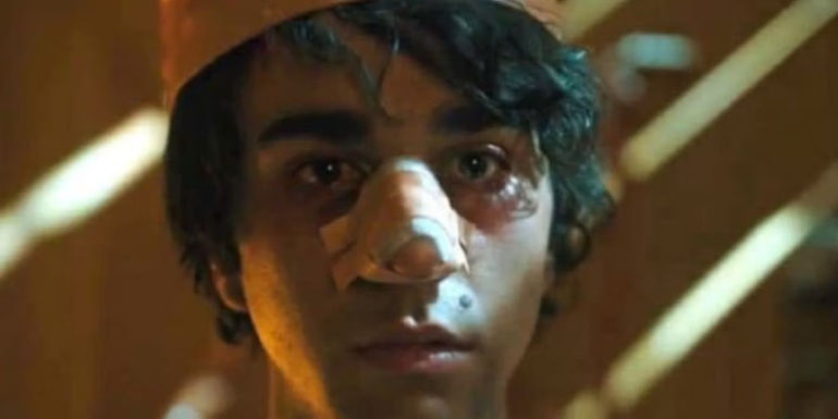Peter with a bandaged nose in Hereditary 
