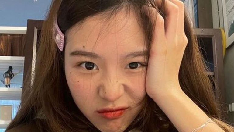 3 dấu hiệu cho thấy mạch máu có khả năng bị tắc nghẽn