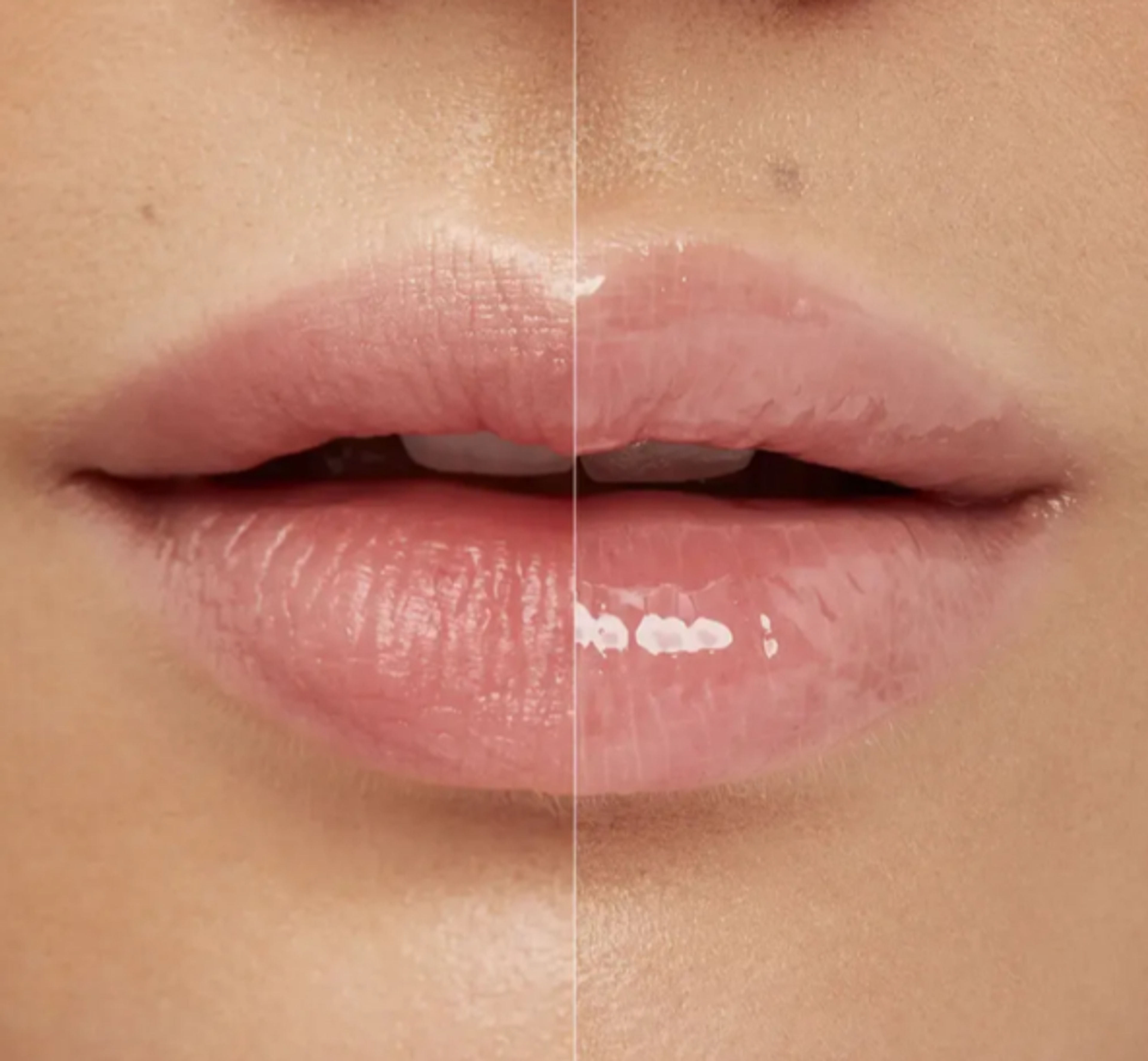 Lip Volume Tutu Rose (Volumizador) 01 — imagem 3