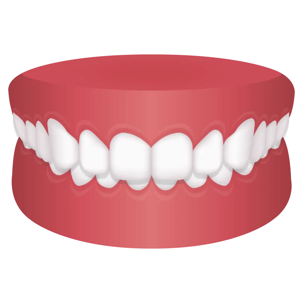 image of Overbite