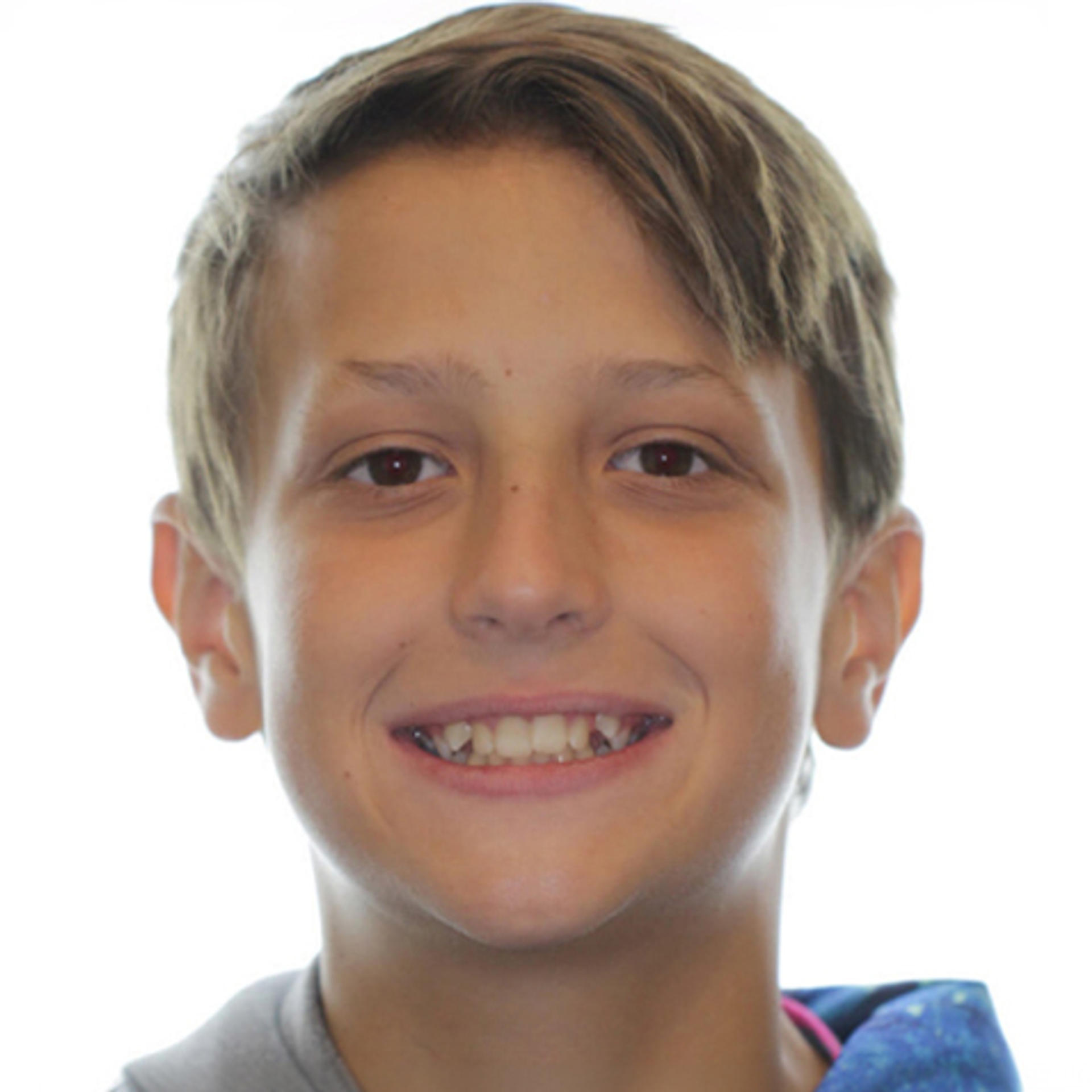 caleb before photo