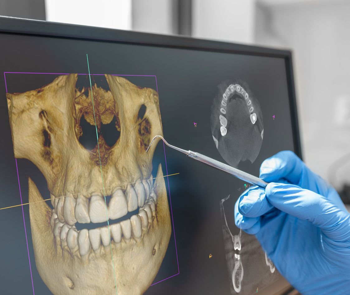 Dental consultation with 3D tomography image