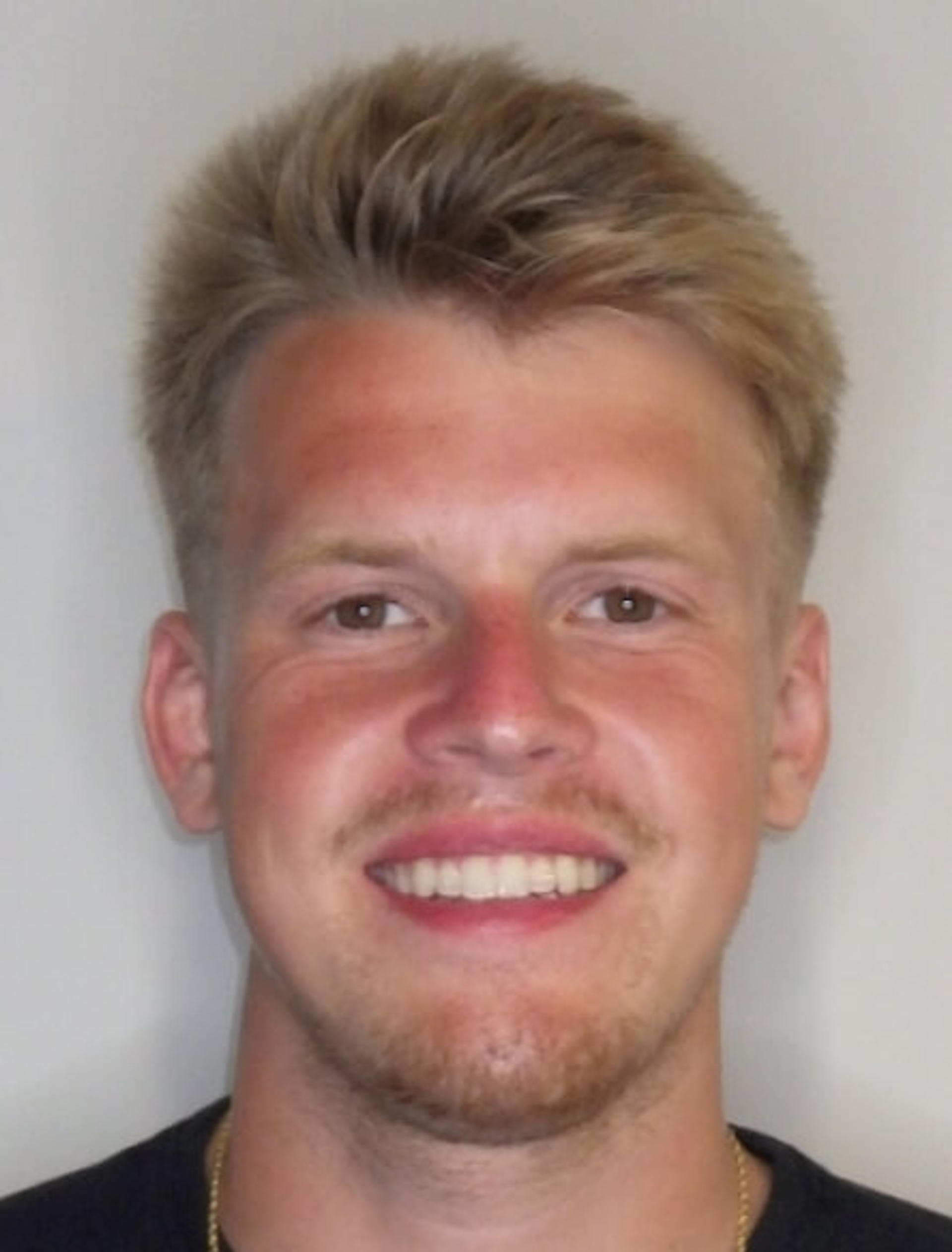 After orthodontic treatment — Reynolds Orthodontics patient