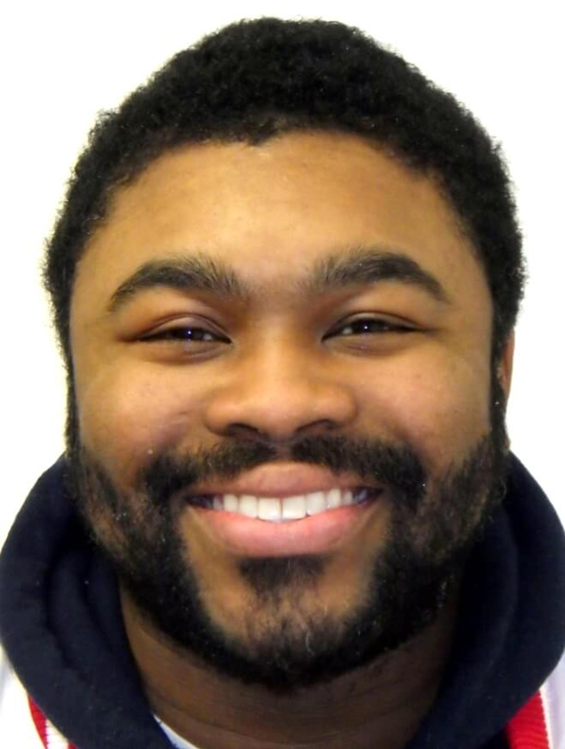 Before orthodontic treatment — Reynolds Orthodontics patient