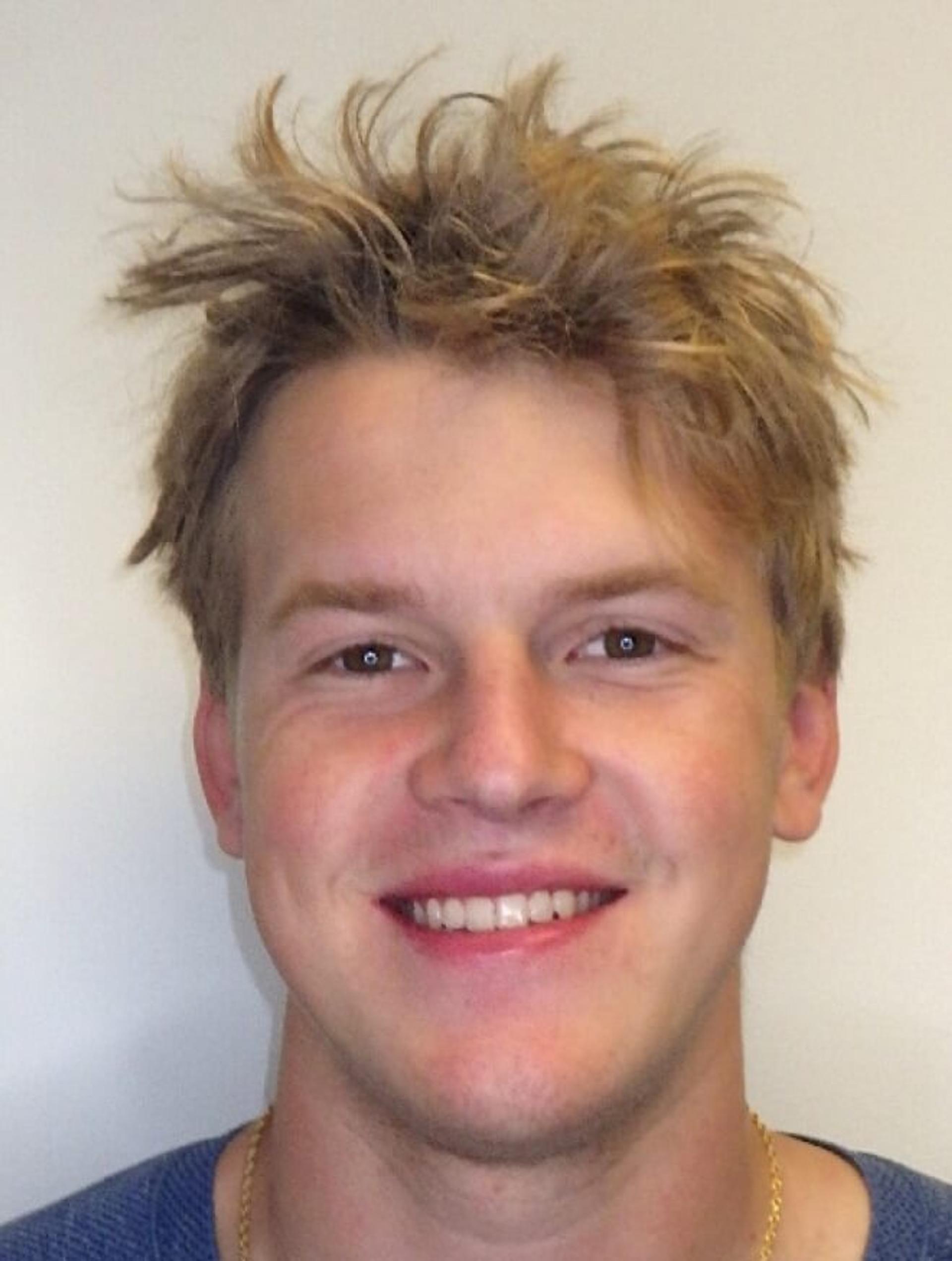 Before orthodontic treatment — Reynolds Orthodontics patient
