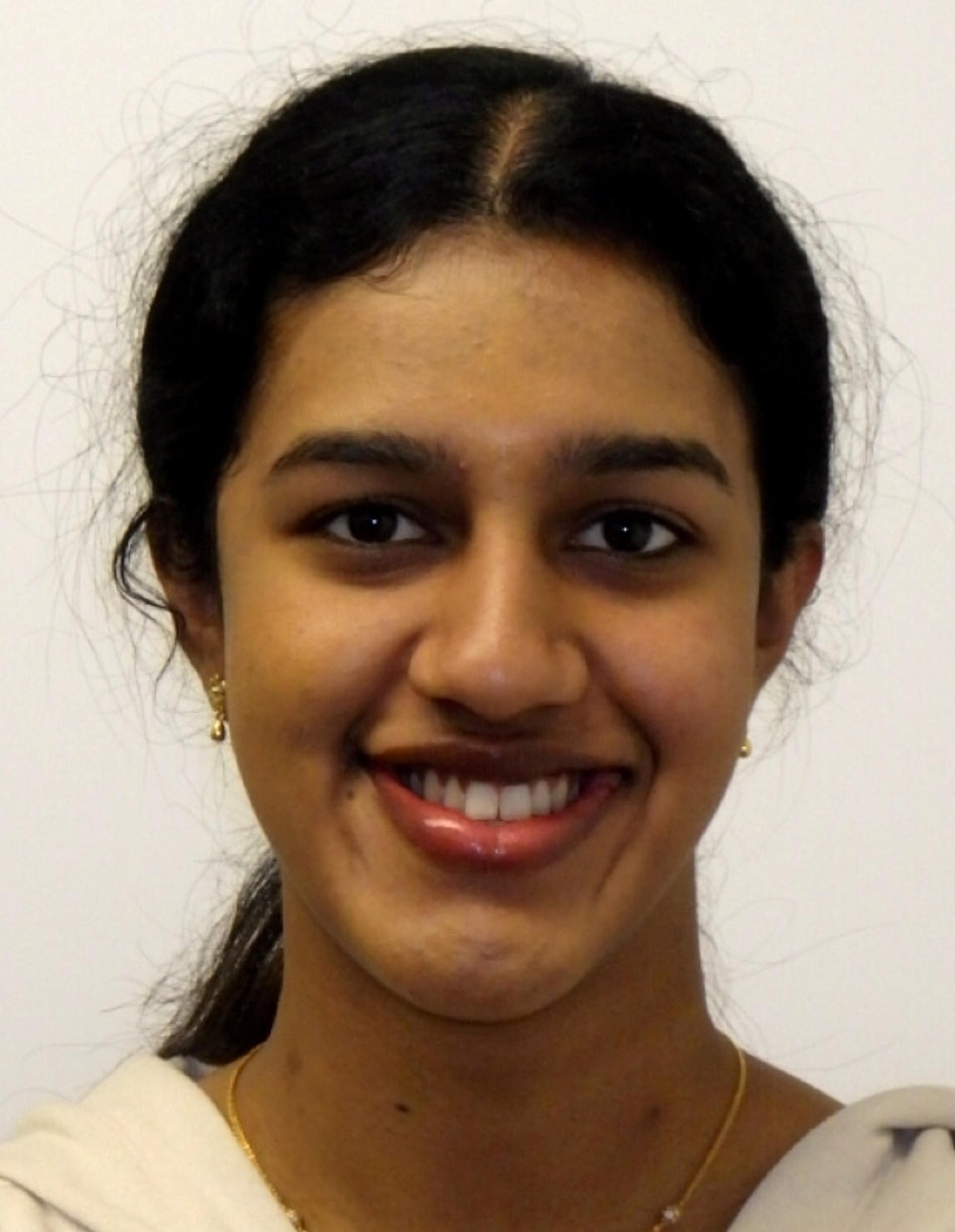 Before orthodontic treatment — Reynolds Orthodontics patient