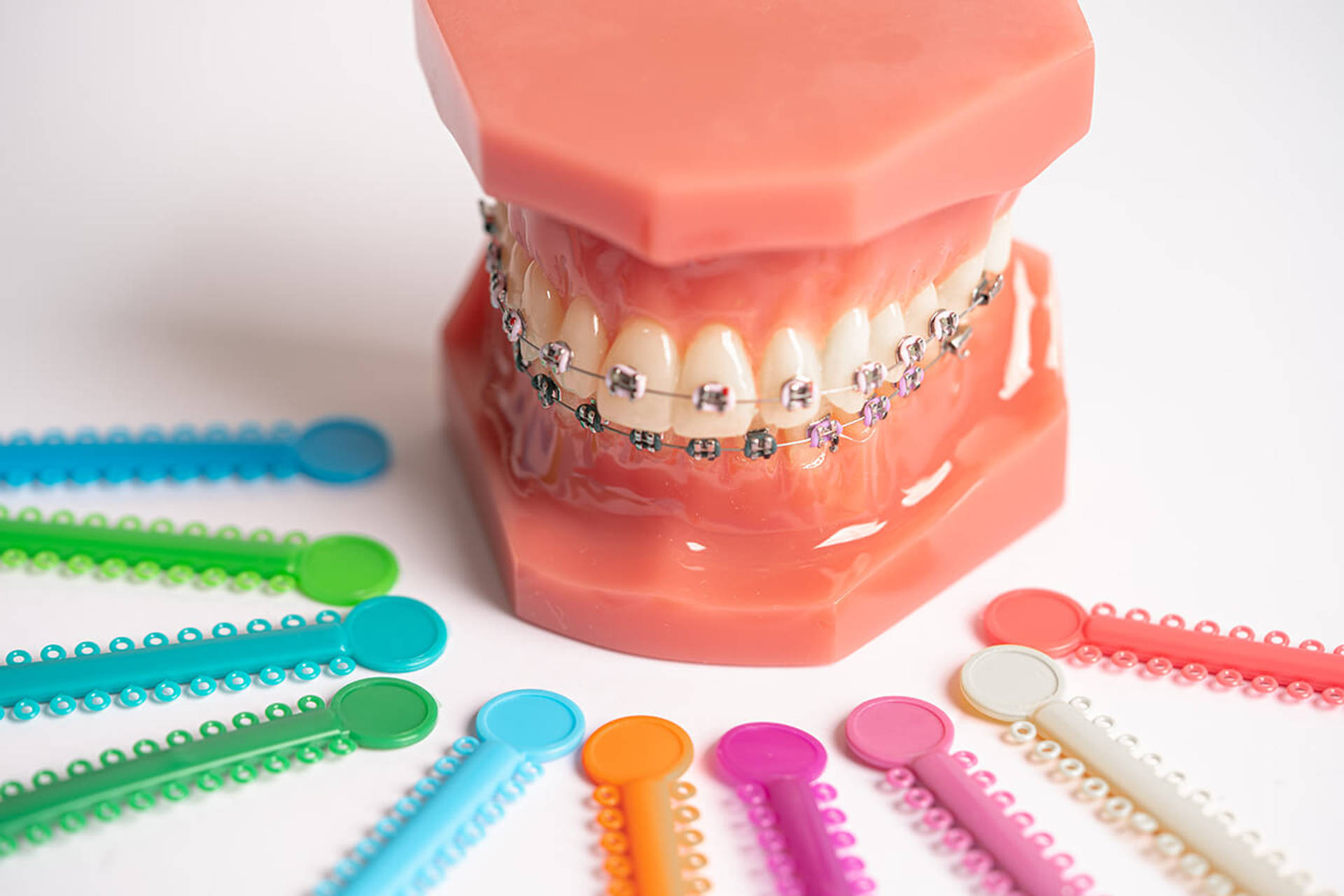 Orthodontic ligatures rings and ties, elastic rubber bands on orthodontic braces, model for dentist studying about dentistry.