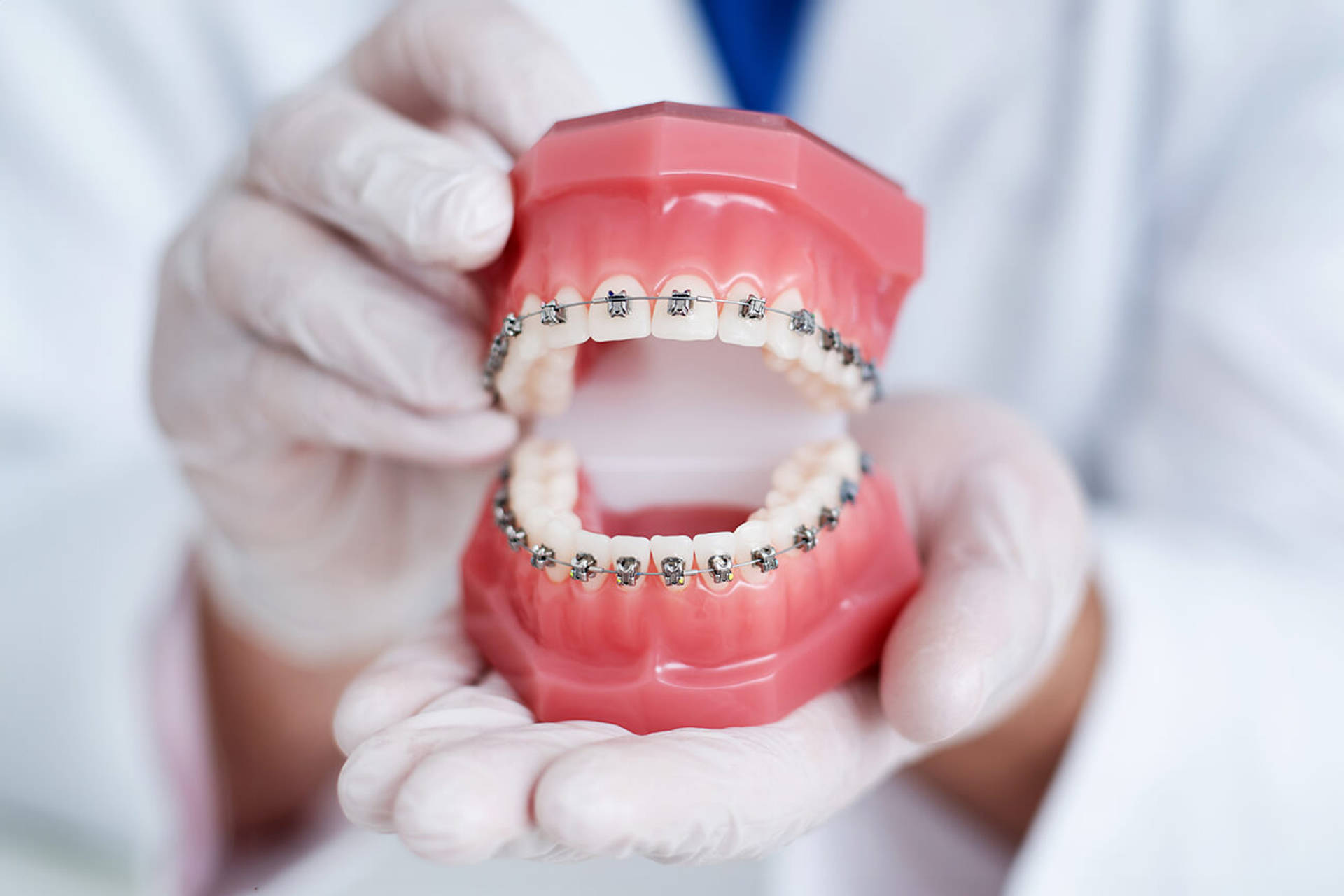 doctor orthodontist shows how the system of braces on teeth is arranged