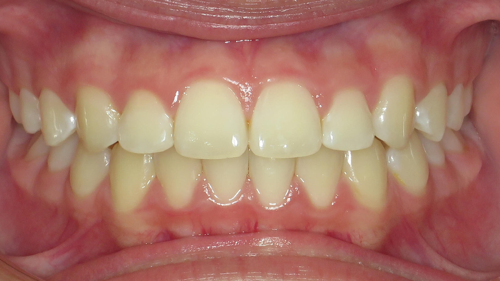 After image 1 of 8