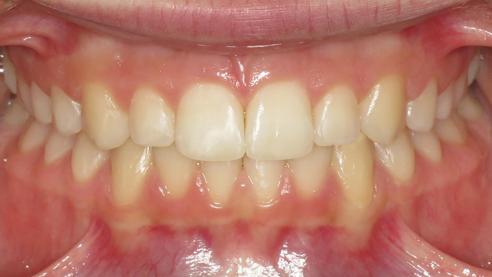After image 3 of 8