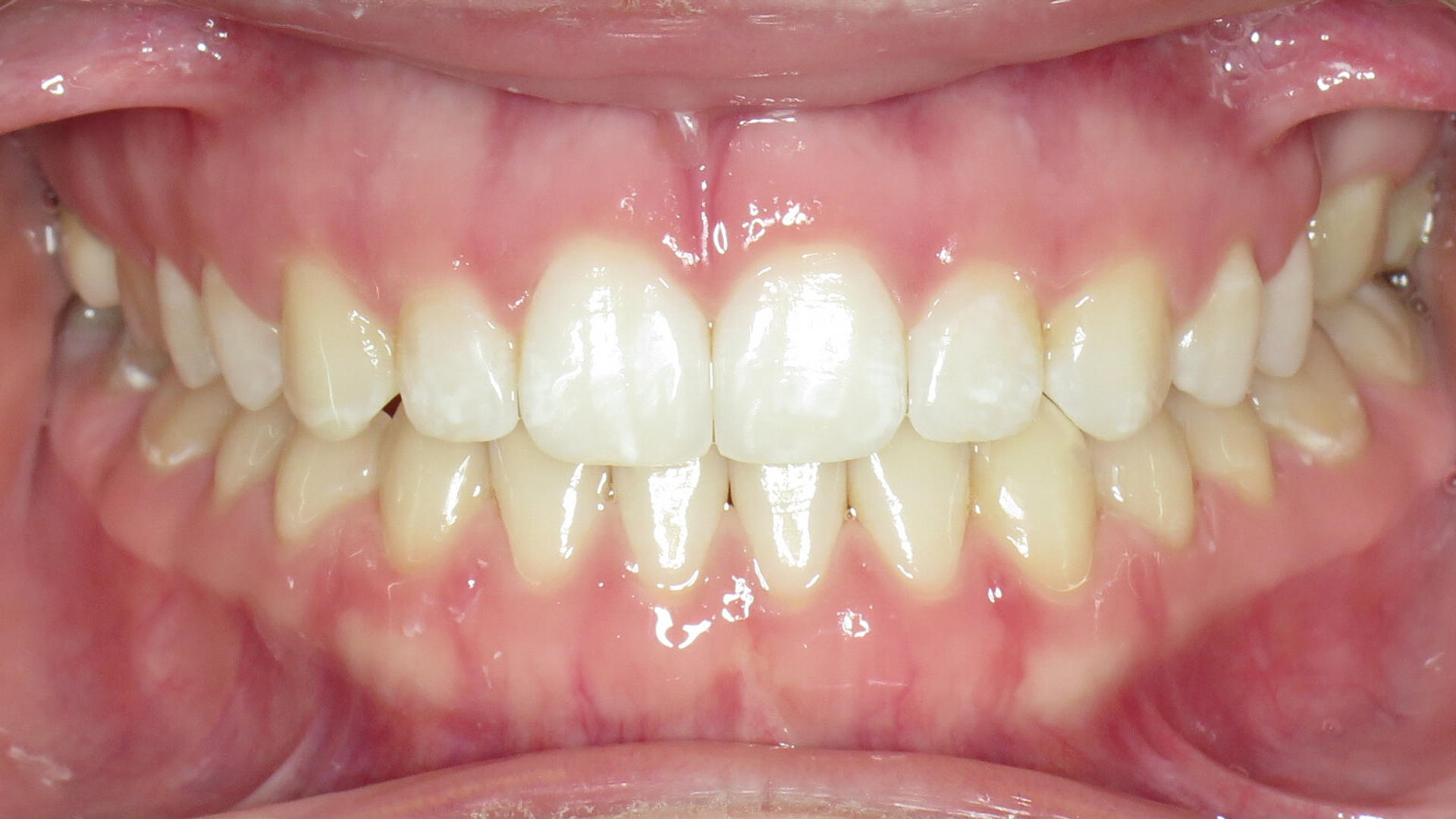 After image 4 of 8