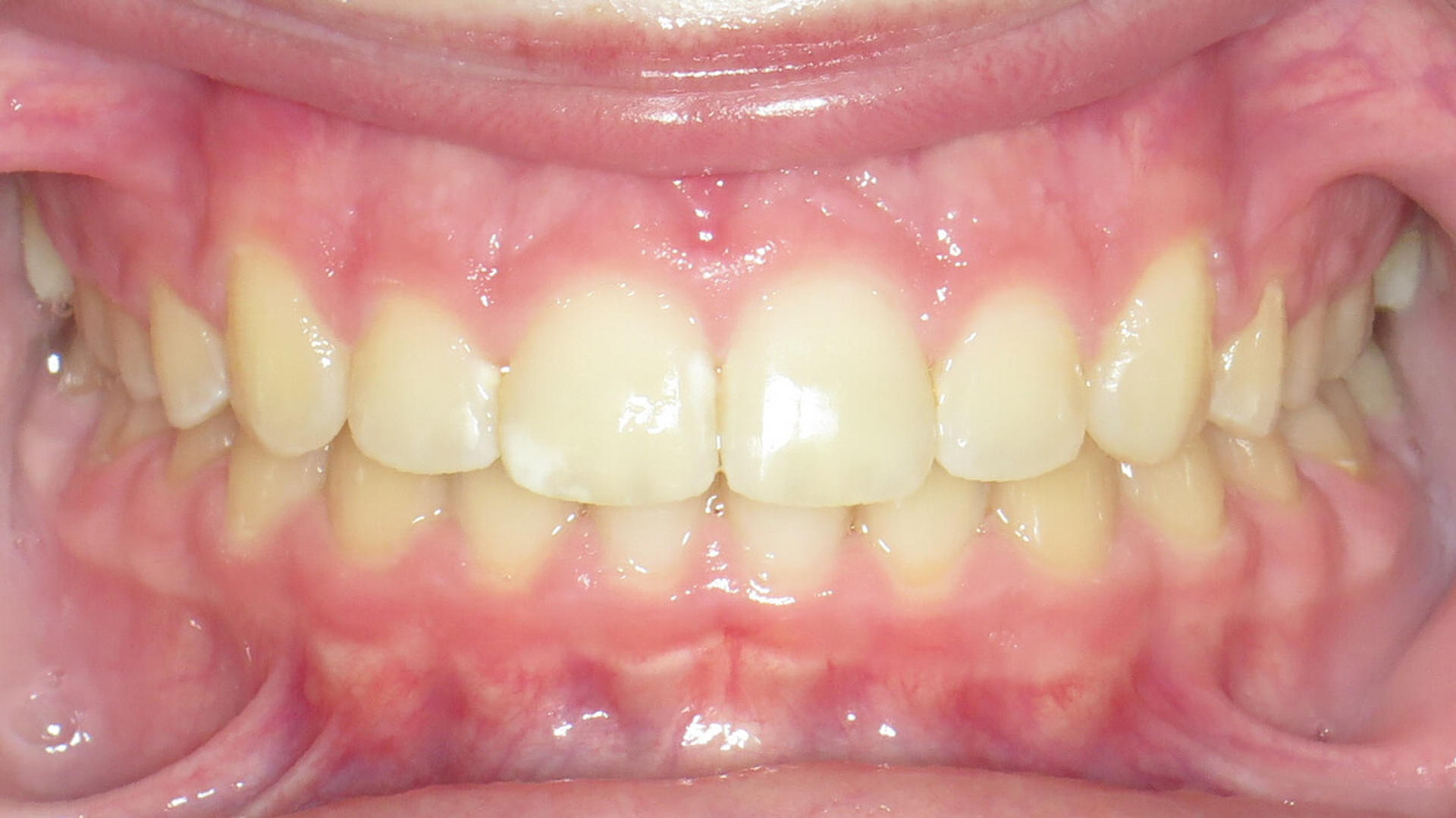 After image 7 of 8