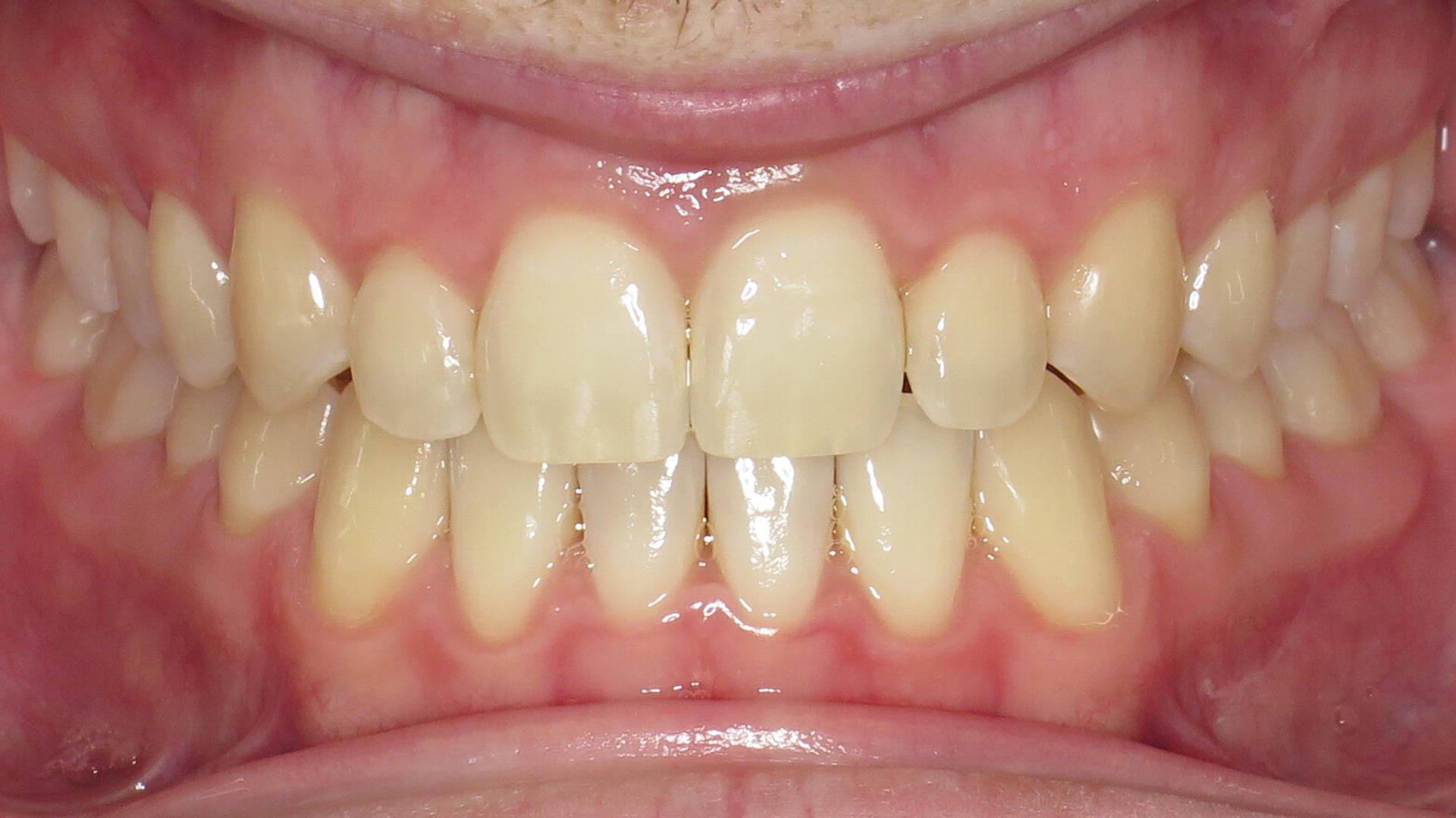 After image 8 of 8