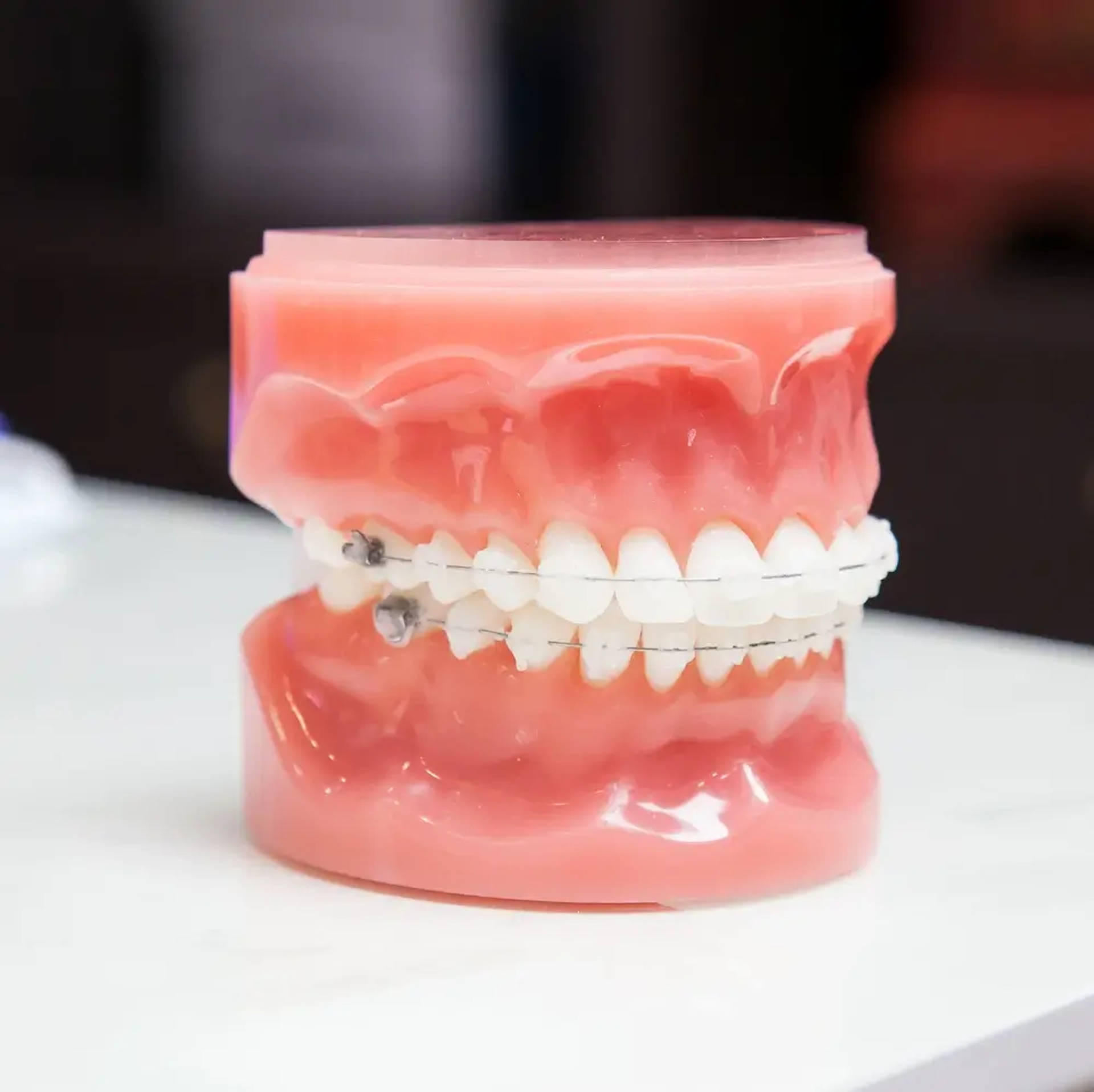 clear braces