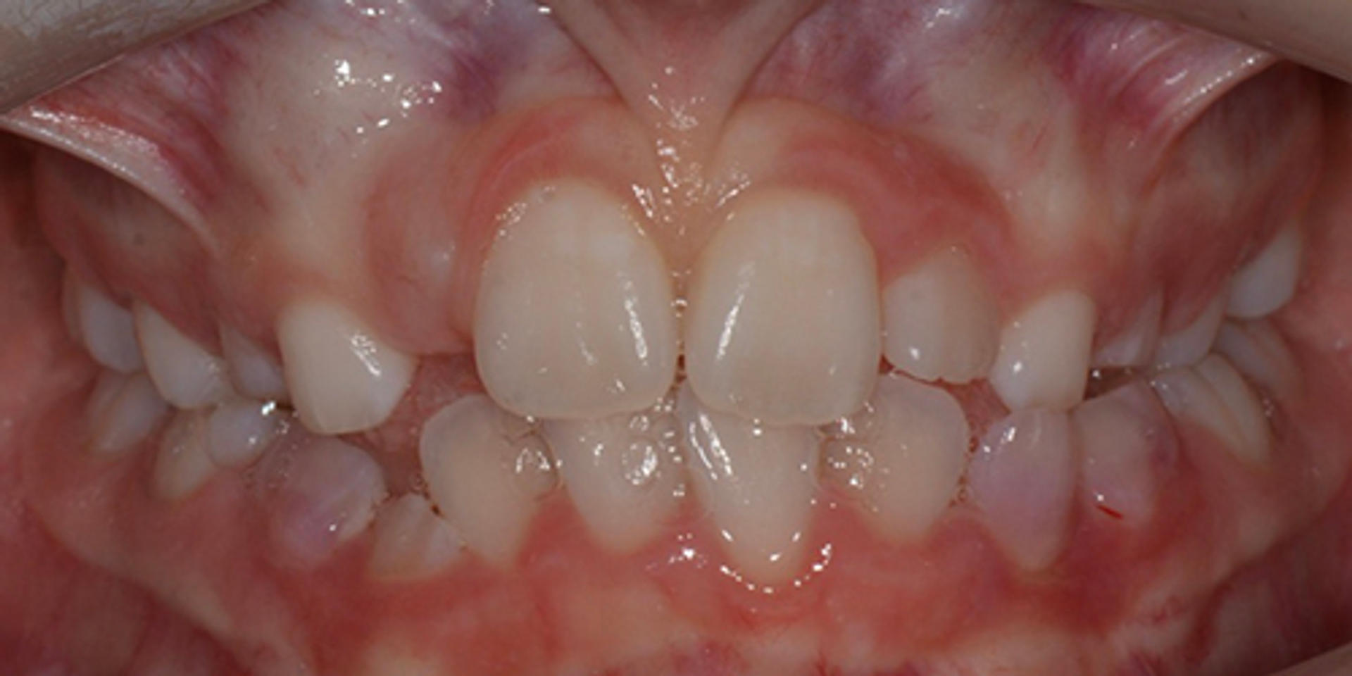 case 01 before 