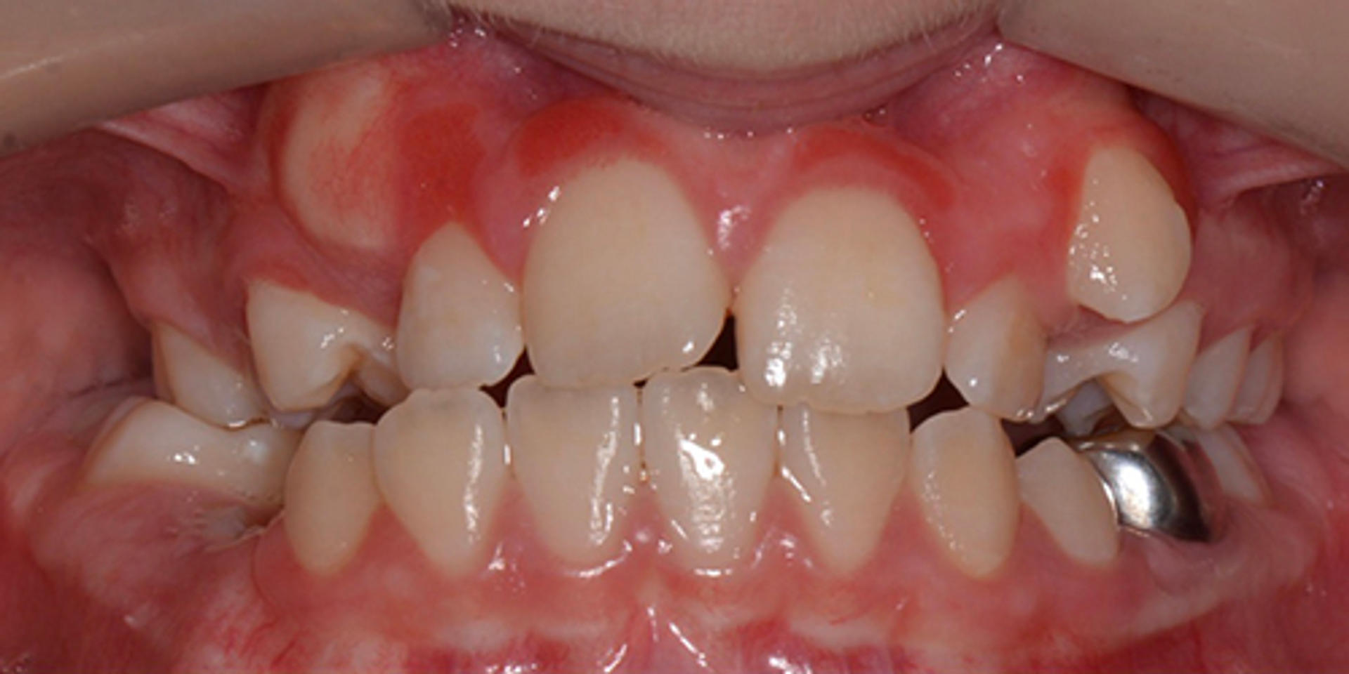 case 02 before 