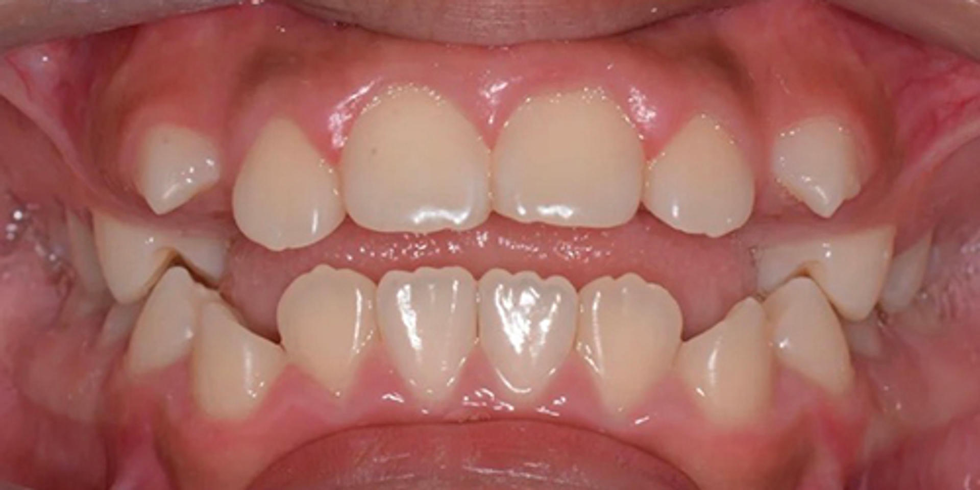 case 03 before 