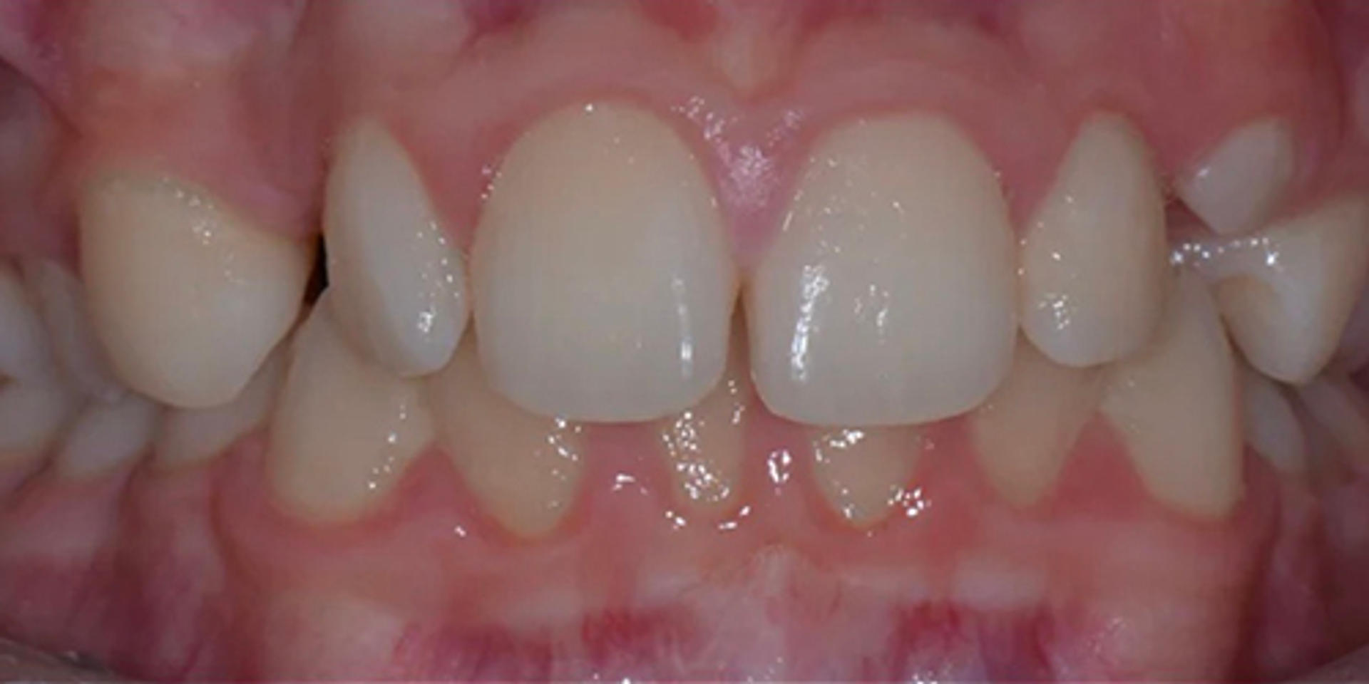 case 04 before 