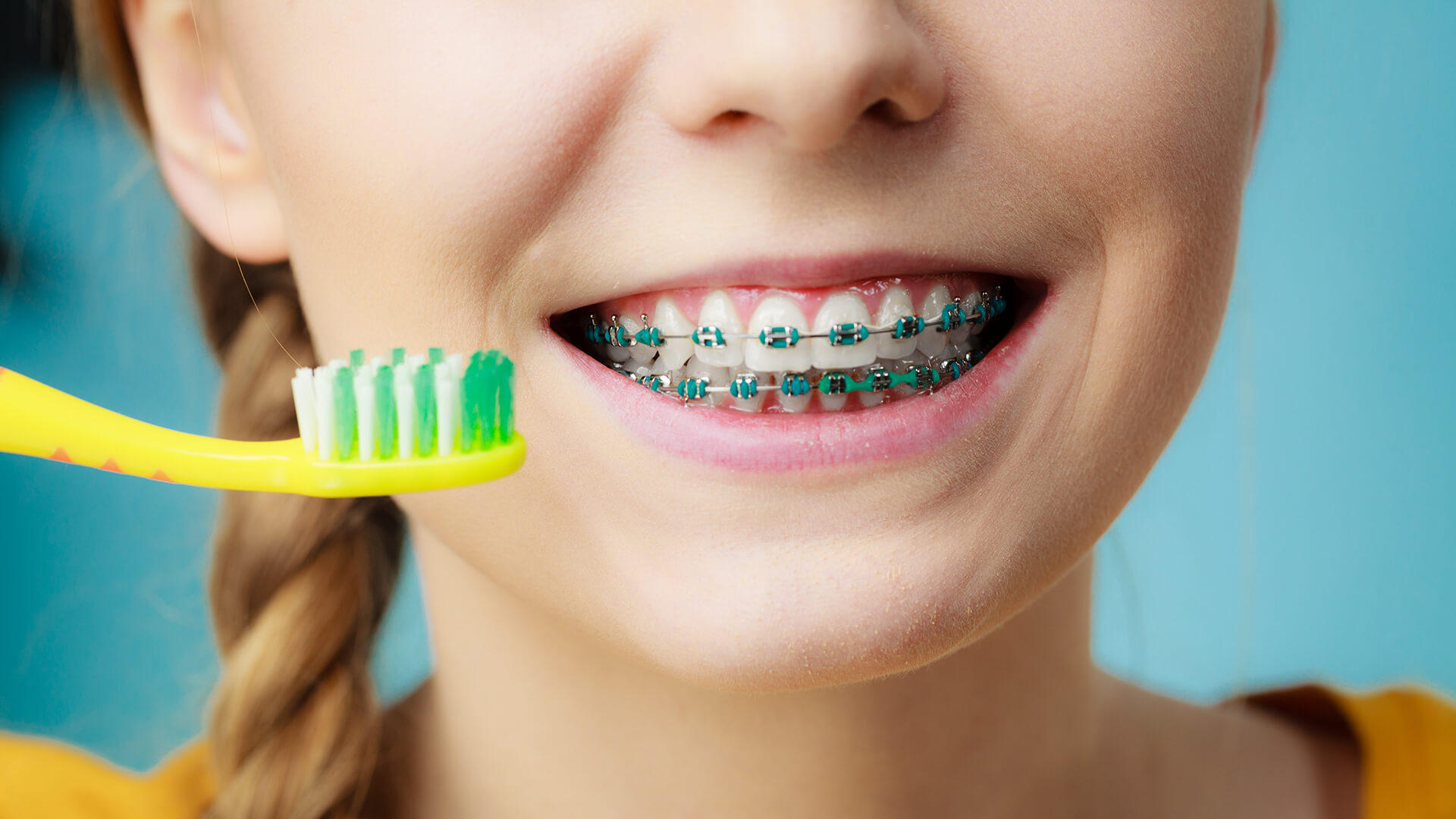 Brushing And Flossing While Wearing Braces