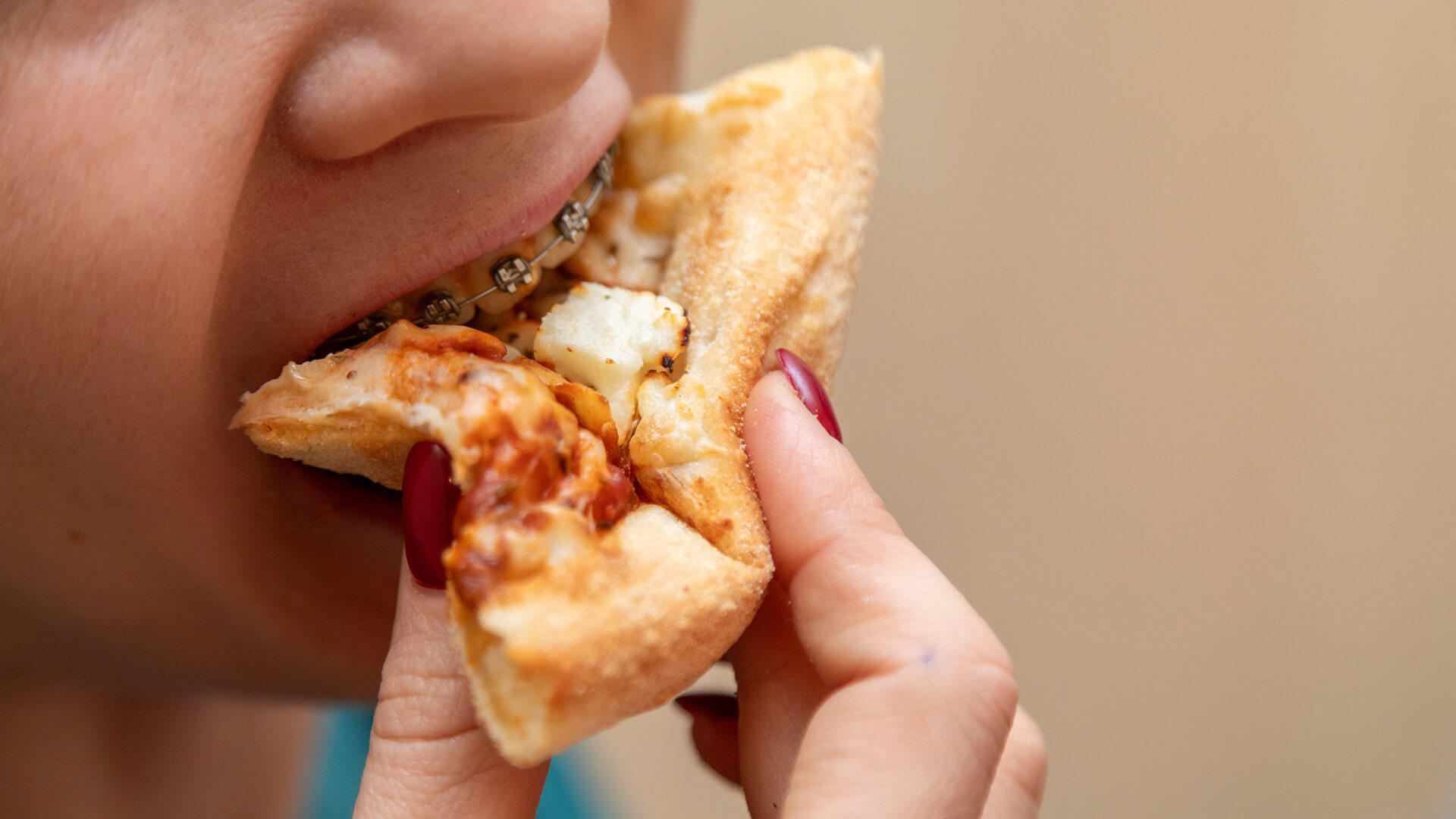 What to Eat When You Have Braces