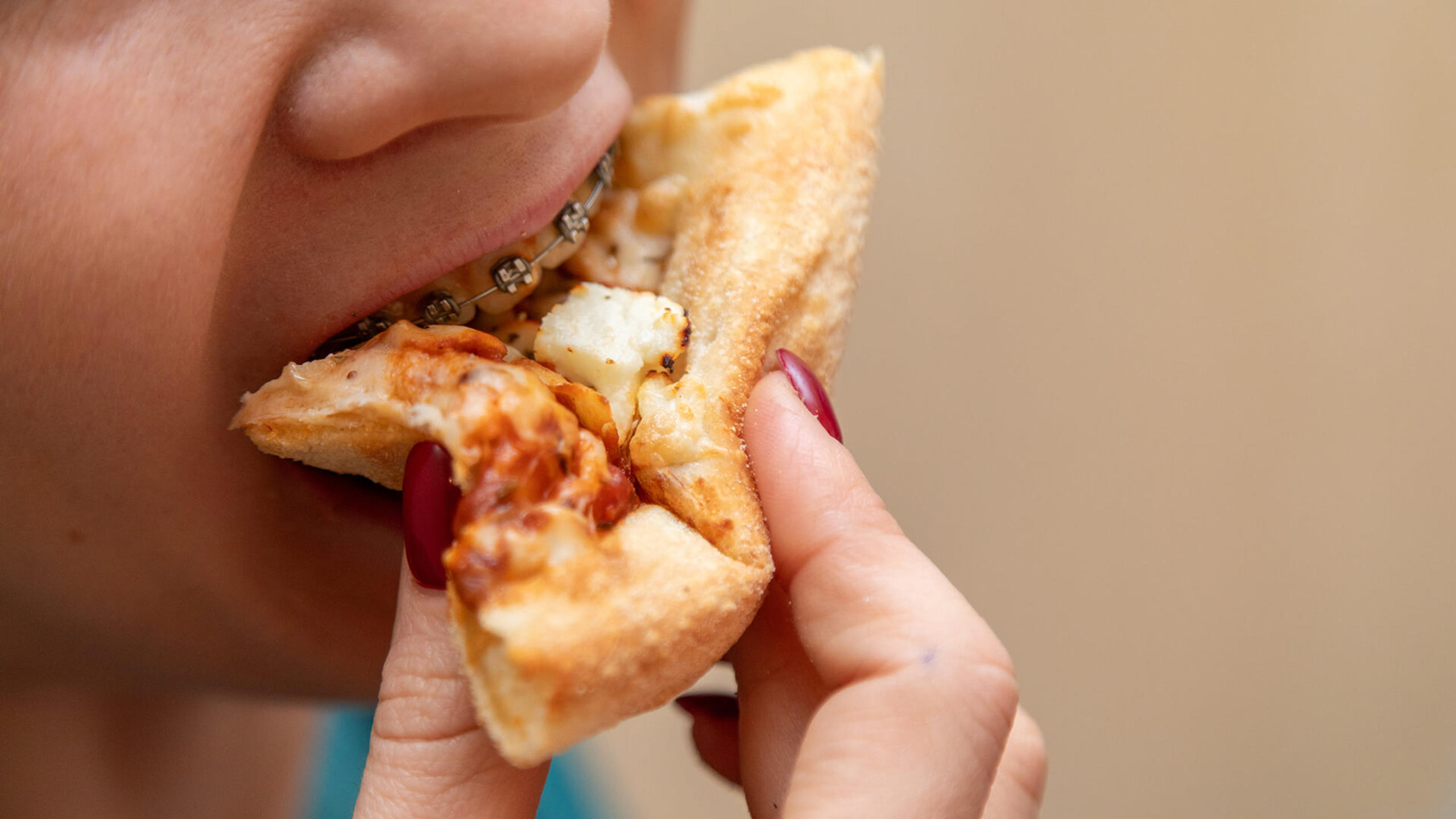 What to Eat When You Have Braces