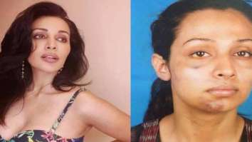 Flora Saini recalls being in abusive relationship for 14 months with “famous producer”; reveals details of physical abuse