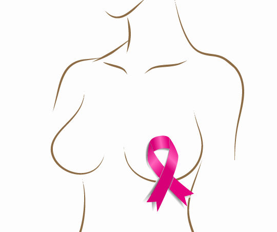 breast reconstruction surgery