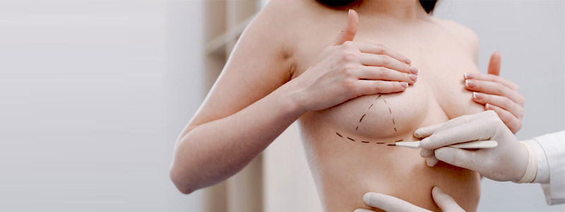 Breast Augmentation Dubai Reviews