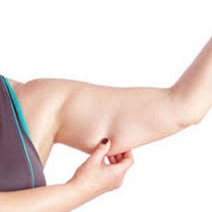 Arm Lift in Dubai