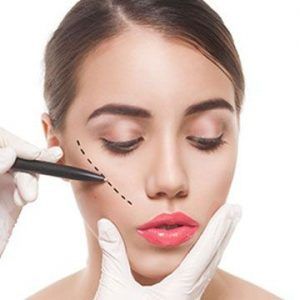 Cheek Implant Treatment in Dubai