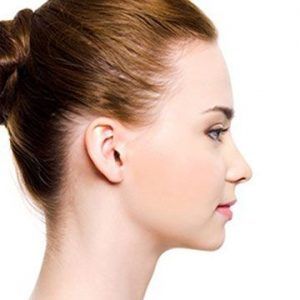 Rhinoplasty in Dubai
