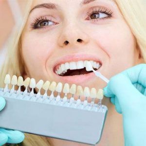dental-implants