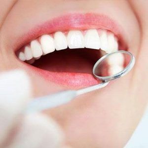 gum-depigmentation-treatment