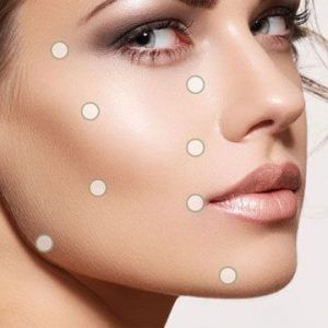 8-point facelift with juvederm