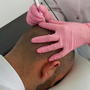 hair-tattoo