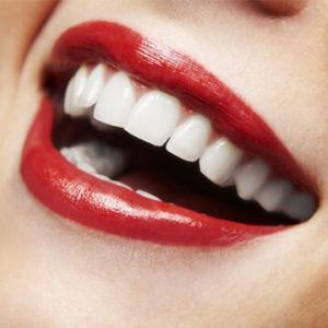 digital smile design